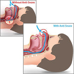 Anti Snore Relief Snoring Stopper Sleeping Aids Noisy Device Nose Clip