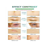 Scar Removal Peel Mask Skin Care Moisturize Cream Original Cell Repair Factor
